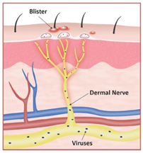 이미지명